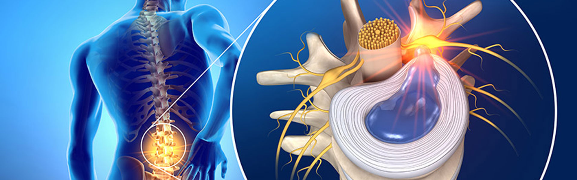 Minimally Invasive Spine Surgery